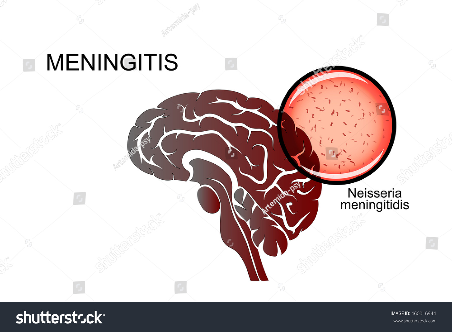 Meningitis B – Vaccine Awareness